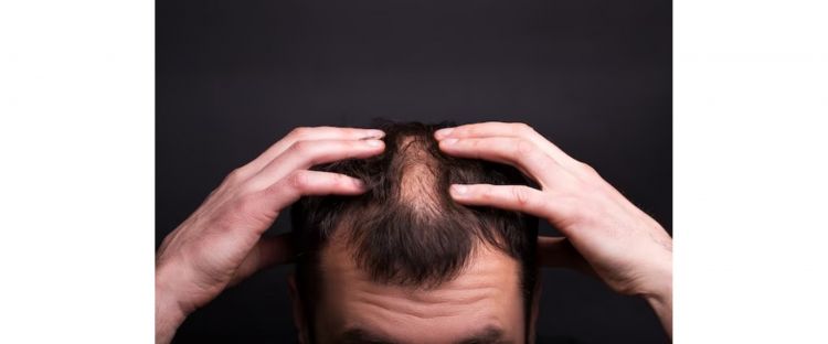 Tak cuma minyak kelapa, ini trik tumbuhkan rambut 10 kali lebih cepat pakai 1 jenis daun