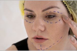 Nggak perlu serum antiaging, ini trik pudarkan garis halus pakai masker botoks dari 1 jenis protein