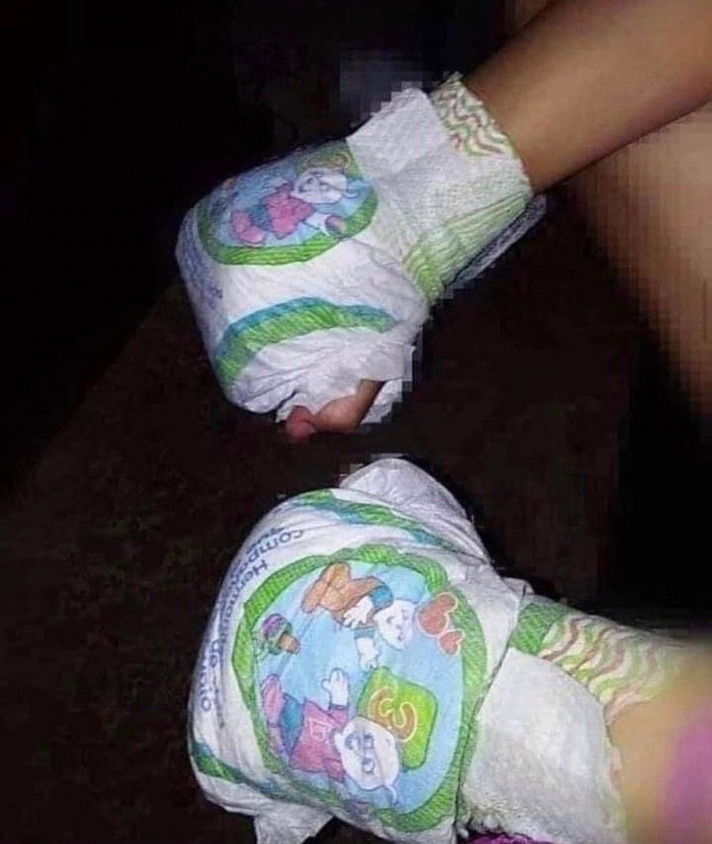 11 Potret lucu pemakaian benda tak sesuai fungsi ini bikin tepuk jidat, ada diapers jadi sarung tinju