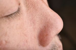 Tanpa lemon, ini trik kecilkan pori-pori agar tak tersumbat komedo pakai 1 jenis tepung