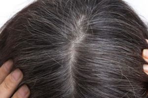 Tak pakai jintan dan urang-aring, ini cara mencegah uban tumbuh kembali dengan 1 jenis minyak