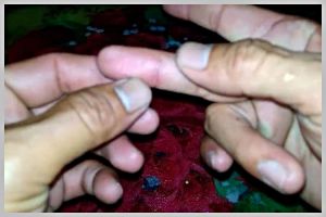 Bukan pakai jarum, begini cara ampuh mengeluarkan duri ikan di tangan cuma pakai 1 bahan dapur