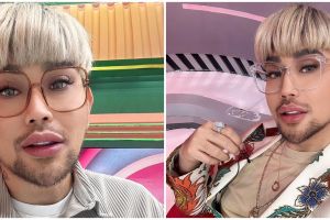 7 Momen Caren Delano jalani operasi hidung di Korea, tetap pede jalan-jalan meski wajah bengkak