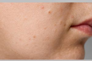 Tanpa lemon, ini cara mencerahkan kulit kusam dan gradakan hanya pakai 1 bahan lalapan