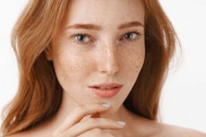 Bukan dengan kunyit dan air mawar, ini trik pudarkan flek hitam membandel pakai 1 jenis buah-buahan