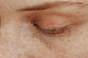 Tanpa tambahan kunyit, begini trik pudarkan flek hitam dan kulit kusam pakai 1 jenis buah-buahan