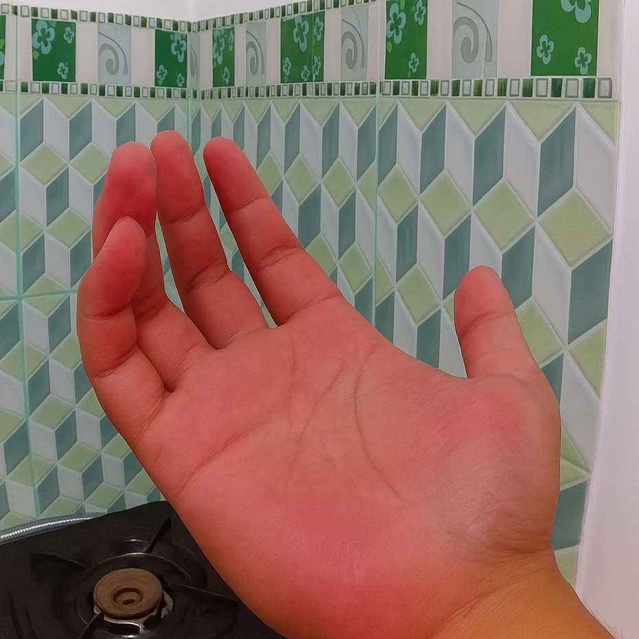 Bukan minyak atau beras, ini trik hilangkan rasa panas di tangan usai potong cabai pakai 1 bahan dapur
