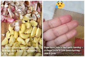 Pakai tambahan 1 bahan dapur, ini cara redakan rasa panas di jari usai memotong cabai dan bawang putih