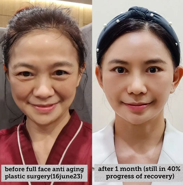 Penampilannya kerap dipuji bak gadis di usia 56, ini alasan nenek Puspa Dewi jalani oplas antipenuaan