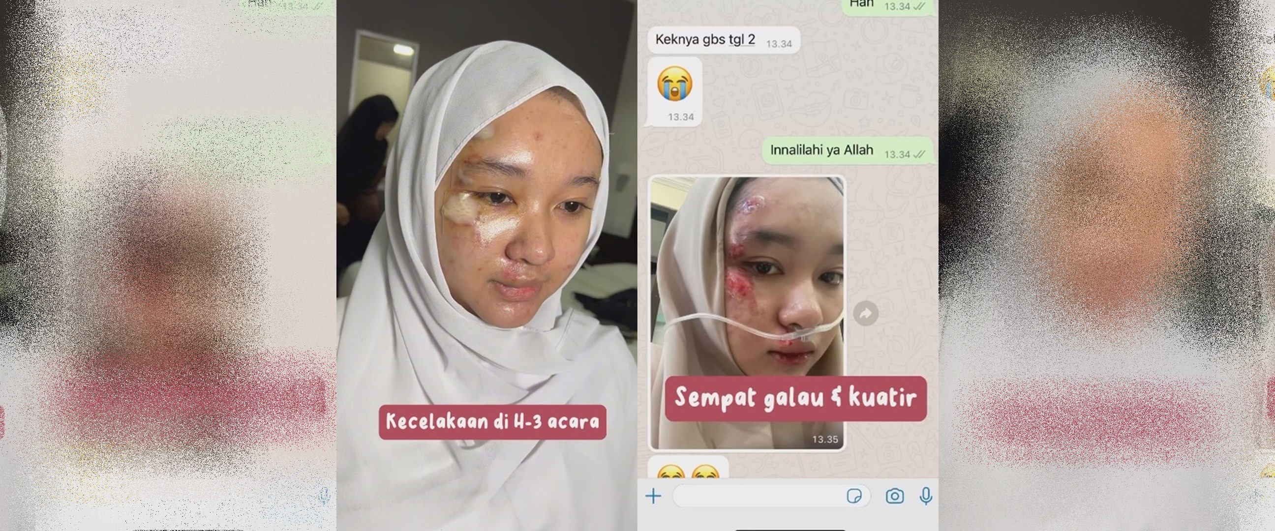 Alami kecelakaan H-3 menikah, pengantin dimakeup MUA ini tetap manglingi meski wajah penuh lecet