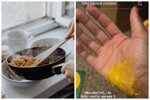 Bukan pakai pasta gigi, ini trik atasi kulit yang terkena panci panas mengandalkan 1 bahan dapur