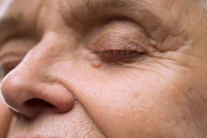 Bukan pakai susu, ini cara atasi keriput agar wajah kembali kenyal hanya dengan 1 bahan dapur