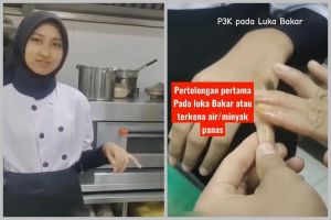 Cara atasi kulit yang terkena minyak panas agar tak melepuh dan berbekas pakai 2 bahan dapur