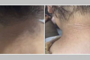 Tak perlu digosok kentang, ini trik hilangkan garis halus dan noda hitam di leher pakai 1 jenis bunga