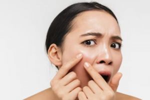 Nggak perlu lemon, ini trik cegah komedo dan pori besar pada wajah berminyak pakai 1 jenis sari buah