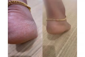 Tanpa beeswax, ini cara memuluskan telapak kaki kasar dan retak pakai 1 jenis minyak