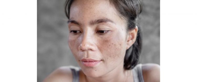 Tak perlu beli, ini cara bikin toner vitamin C pencerah wajah kusam