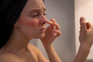 Tanpa calming serum, ini trik bikin kulit iritasi kemerahan adem dalam 5 menit pakai 1 jenis makanan