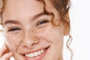 Wajah mulus antinoda, ini trik pudarkan flek hitam pada wajah tanpa laser dengan 2 jenis buah-buahan