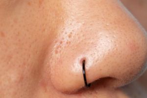 Tak perlu tambahan lemon, ini cara mengecilkan pori besar dan tersumbat pakai 1 jenis bahan minuman