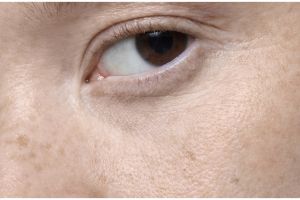 Hasilnya terlihat dalam seminggu, ini trik wanita Jepang atasi flek hitam pakai 1 bahan lalapan