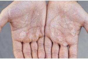 Tanpa petroleum jelly, ini cara atasi kulit tangan kering dan bersisik putih pakai 1 jenis sayuran