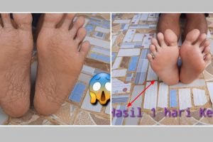 Tanpa krim penghalus tumit, ini trik bikin telapak kaki jadi mulus pakai getah 1 jenis buah
