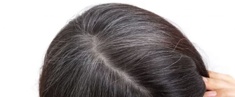 Tanpa kopi dan kulit bawang merah, ini cara atasi tumbuhnya uban berlebih cuma pakai 1 bahan minuman