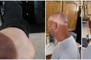 11 Potret lucu kulit belang ini buktikan kalau cuaca panas sekarang sudah nggak ketolong