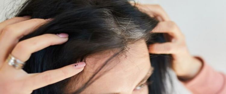 Tak cuma gunakan kemiri, ini cara mencegah munculnya uban prematur pakai tambahan 1 jenis daun