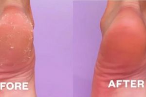 Tanpa aloe vera, ini cara bikin tumit kaki retak jadi lembut bak kulit bayi pakai 1 jenis minyak