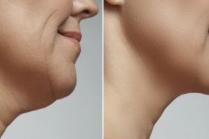 Bukan pakai masker beras, ini cara menghilangkan kerutan di wajah mengendur dengan 1 jenis sayuran