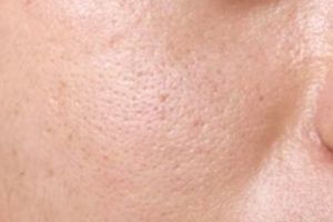 Hasilnya bikin komedo keluar sendiri, ini trik membuat scrub pengecil pori-pori pakai 1 jenis buah