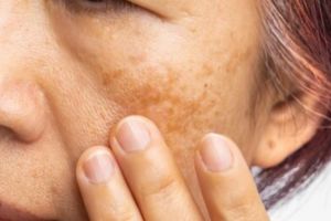 Tanpa perawatan mahal, begini cara atasi pigmentasi akibat penuaan pakai masker dari 1 jenis tepung