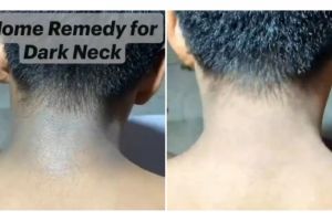 Cerah merata tanpa krim pemutih, ini cara atasi leher hitam berdaki pakai 1 jenis pembersih gigi