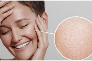 Tak pakai petroleum jelly, ini trik melembapkan kulit kering di wajah pakai 1 jenis tanaman