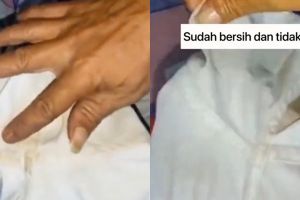 Bukan pakai detergen, ini cara hilangkan noda bekas deodoran di baju putih pakai 1 jenis minyak