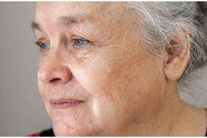 Tanpa teh hijau dan lemon, ini trik bikin wajah bebas flek hitam dan kerutan hanya pakai 1 umbi-umbian