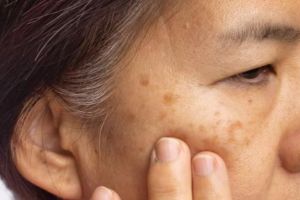 Tak cuma putih telur, ini cara pudarkan kerutan dan flek penuaan dengan tambahan 1 jenis buah-buahan