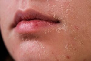 Tanpa aloe vera, ini trik bikin kulit kering bersisik jadi lembut dan kenyal pakai 1 jenis minuman