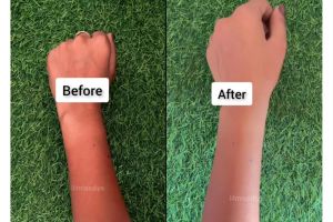 Tanpa gunakan produk lulur, ini trik memutihkan tangan belang akibat panas pakai 1 jenis buah