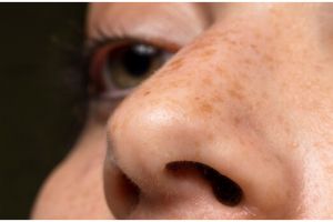 Tanpa beli masker kunyit, ini trik cerahkan flek hitam di wajah agar glowing pakai 1 campuran minuman