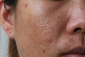 11 Rekomendasi skincare untuk mengecilkan pori-pori di bawah Rp 200 ribu, wajah bersih dan mulus
