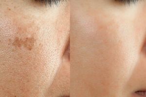 Tanpa beli produk scrub, ini trik cerahkan wajah kusam dan penuh flek hitam pakai 2 jenis minuman