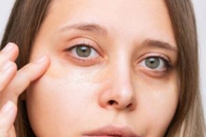 Tanpa kunyit dan kentang, begini cara mencerahkan kantung mata hitam pakai krim dari 1 jenis buah