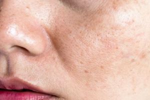 Tanpa pakai scrub oatmeal, ini cara bikin pori wajah mengecil dan bersih optimal dengan 1 jenis rempah