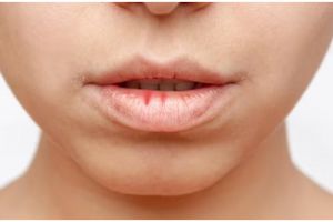 Kembali merah alami tanpa petroleum jelly, ini cara atasi bibir kering dan kusam pakai 1 jenis buah
