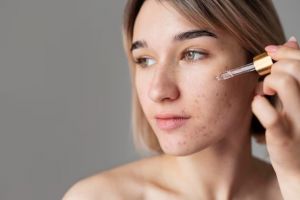 11 Rekomendasi skincare untuk menghilangkan bekas jerawat hitam di bawah Rp 200 ribu, wajah bebas noda