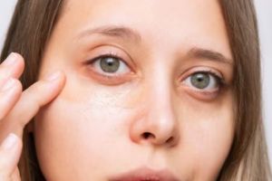 Tanpa tambahan kunyit dan madu, ini trik pudarkan kantung mata menghitam cuma pakai 1 sumber protein