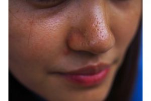 Bukan diusap pakai es, ini trik bikin toner rapatkan pori-pori kulit berminyak dengan 1 jenis sayuran